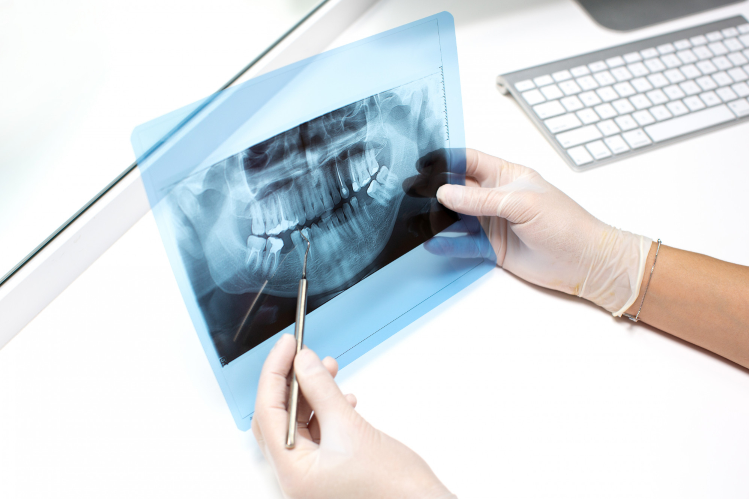 dentist-examines-x-ray-photo-teeths